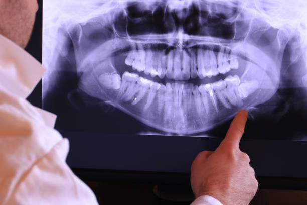 Best Pediatric Emergency Dentist in Huxley, IA