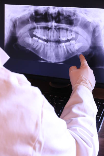 Best Emergency Dentist for Lost Fillings or Crowns in Huxley, IA